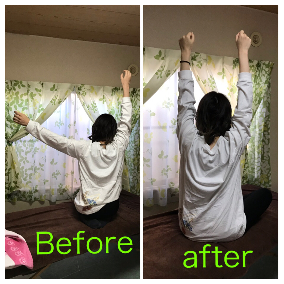 上がらない腕を施術しました！